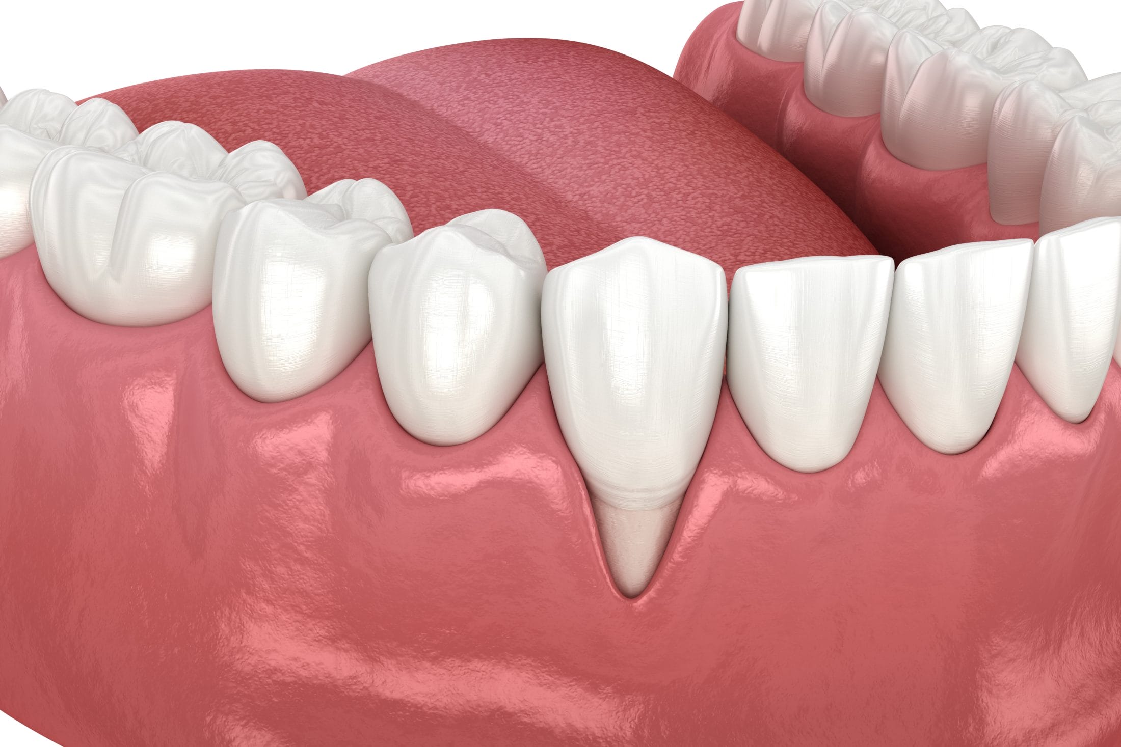 The Hidden Link Between Gum Health and Heart Health: What Every Adult Should Know