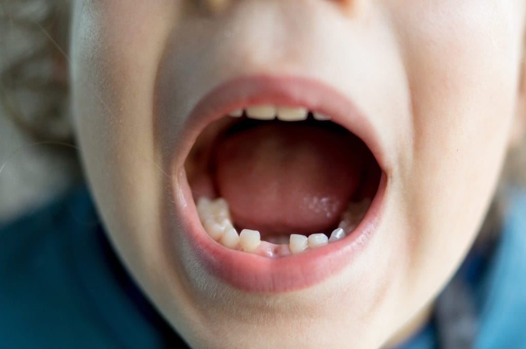 Pediatric dentistry in 2026: Shaping Lifelong Oral Health