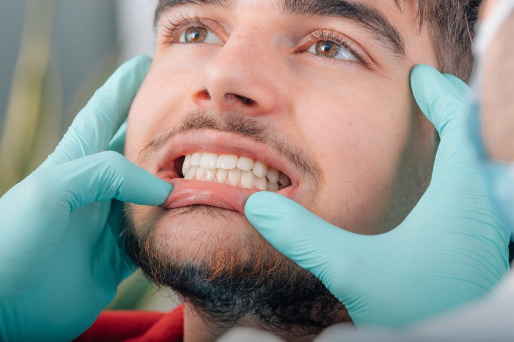 How Curodont Treatment Helps Stop Cavities Before They Start